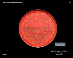 staphylococcus aureus on blood agar agar plate, staph in petri dish 
